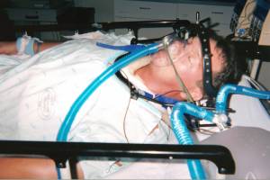 coma
